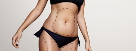 Liposuction Recovery – What You Should Expect