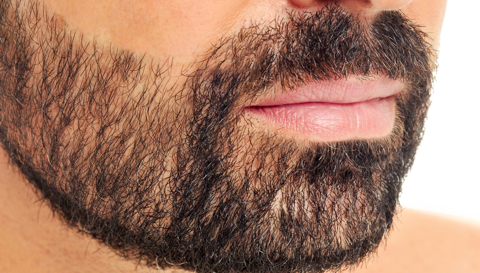 Eyebrow and Facial Hair Transplant