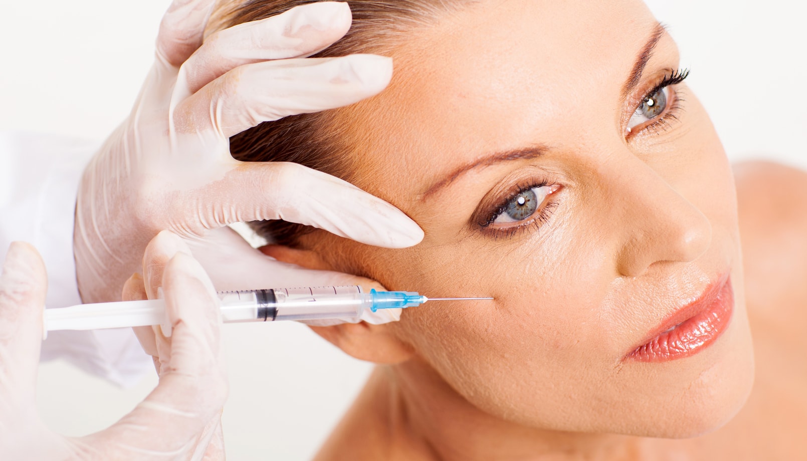 Fat Injections vs. Fillers