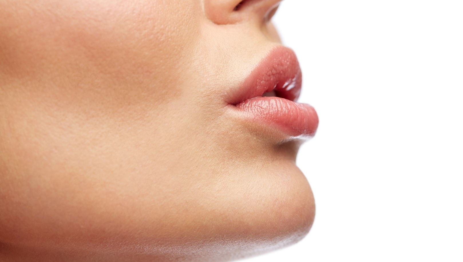 Types of Lip Augmentations