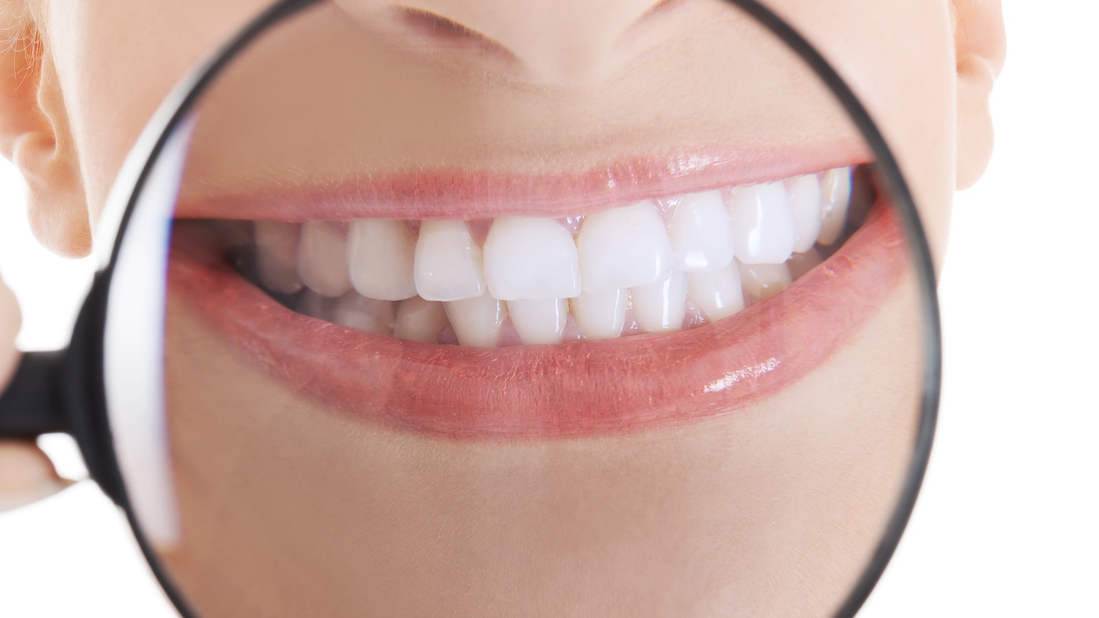 Vital and Nonvital Teeth Whitening