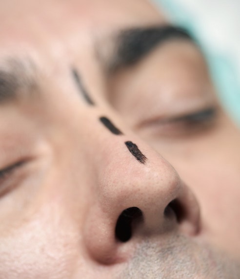 A Device Says It Changes The Nose Appearance In 30-Seconds