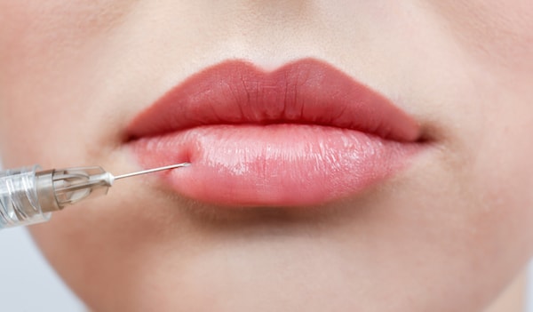 Dermal Fillers for the lips - what you should know