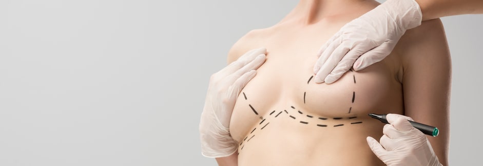 Breast Lift vs. Breast Implants- Which Procedure is the Right One for You? 