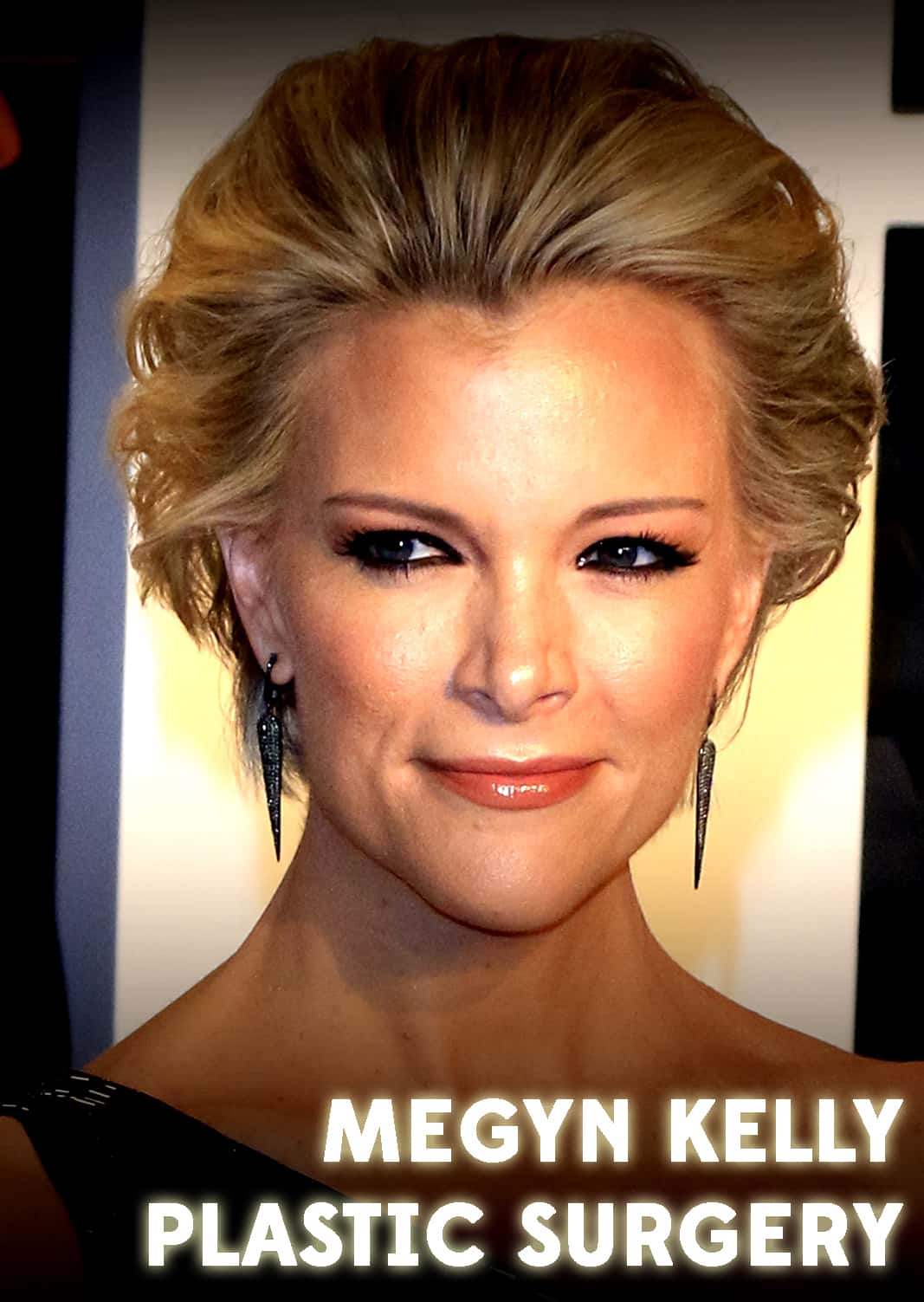Did Megyn Kelly get plastic surgery recently? A lot of experts seem to think so!