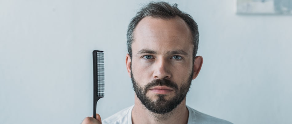 Hair Loss – Why it Happens and How it Can be Treated
