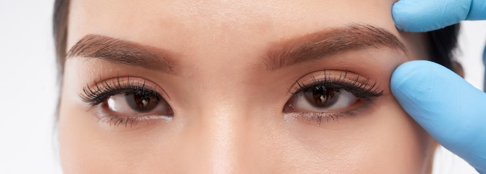 See how a brow lift can help