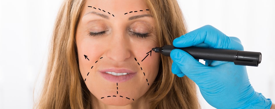 Facial anatomy of the facelifts