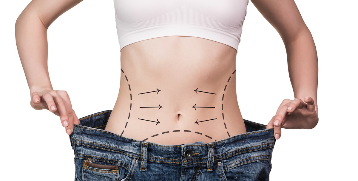 Learn how Liposuction Removes Fat that is Hard to Eliminate