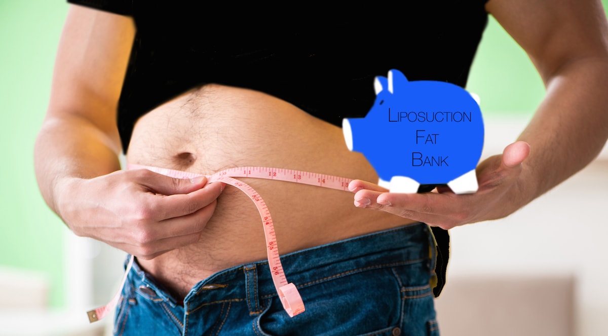 Discover how Fat Banks Store Fat after Lipo for Future Use