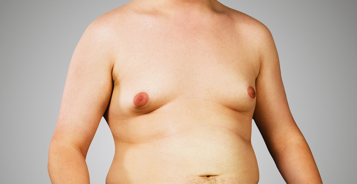 Men are having breast reduction surgery