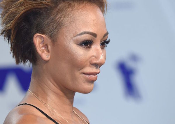 Did former Spice Girl Mel B have plastic surgery?