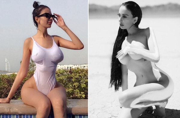 Model Has Buttock Injections to Look Like a Kardashian