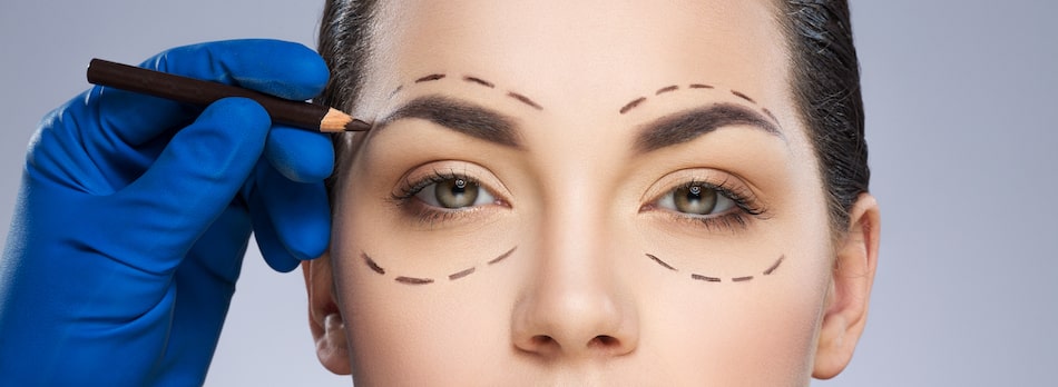 Cosmetic Eyelid Surgery - Patient Guide