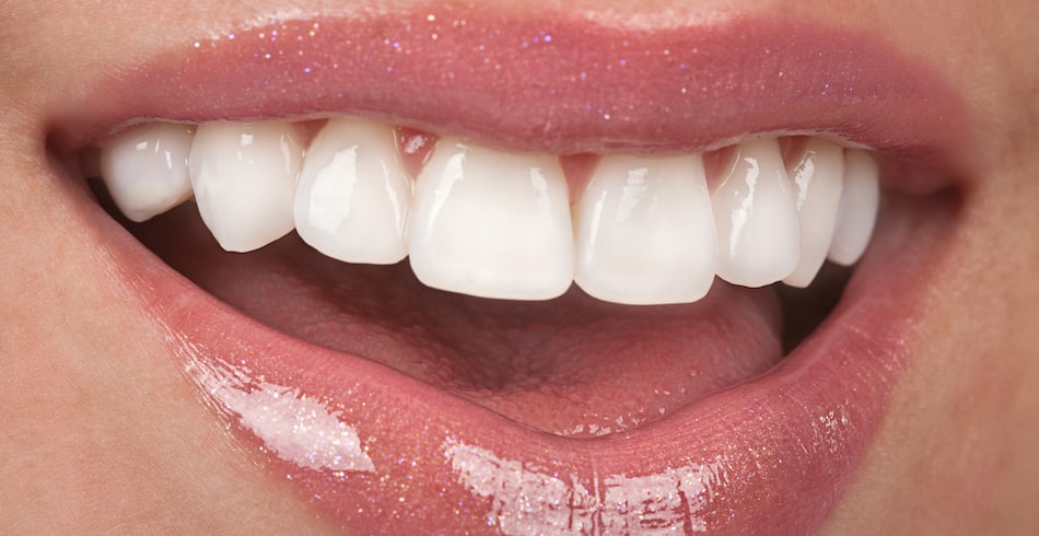Smile Makeover - Learn How it Enhances the Smile