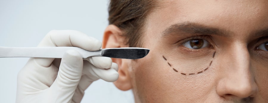Upper Eyelid? Lower Eyelid? Which Type of Surgery is Right for You? 