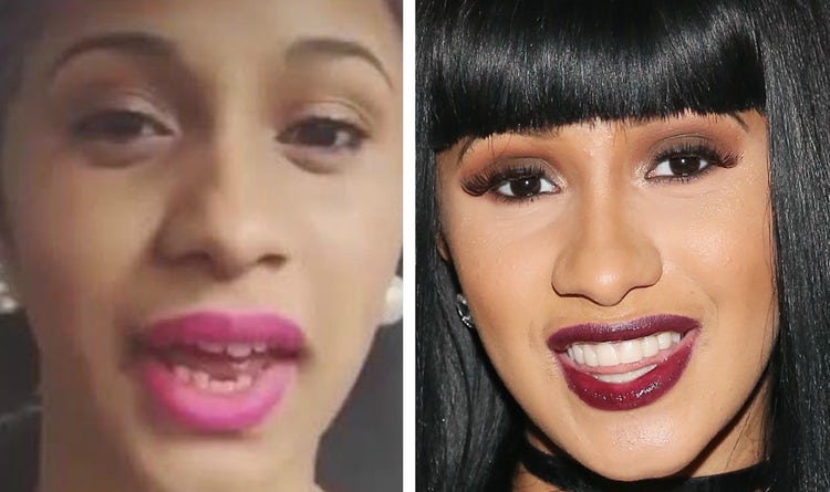 Rapper Cardi B Didn't Always Have That Smile