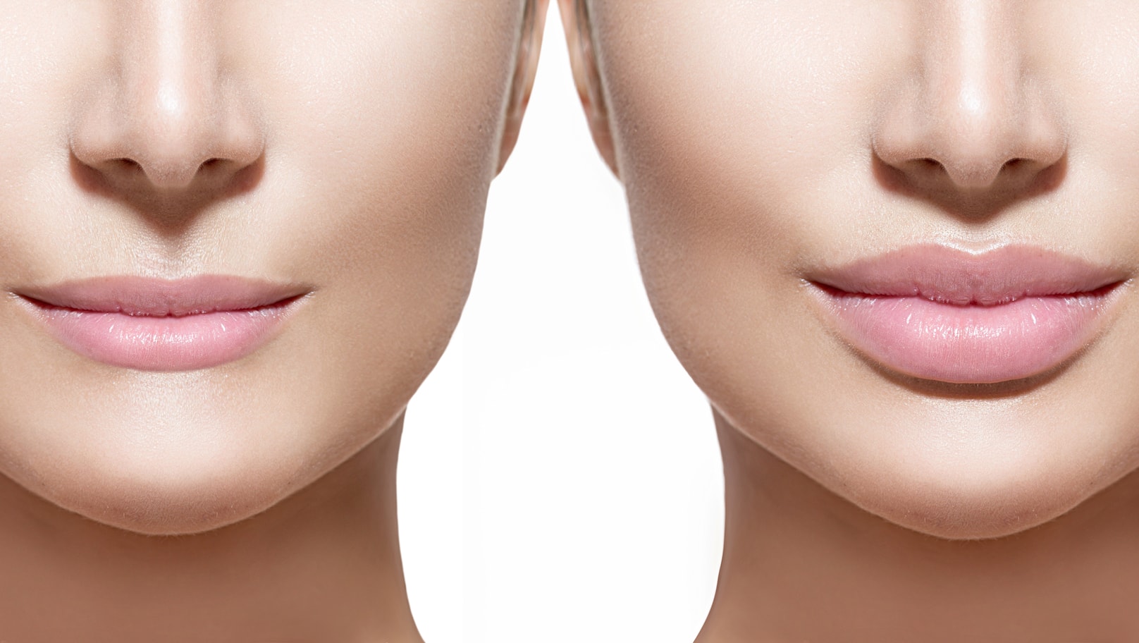 Lip Fillers for Young and Old Patients