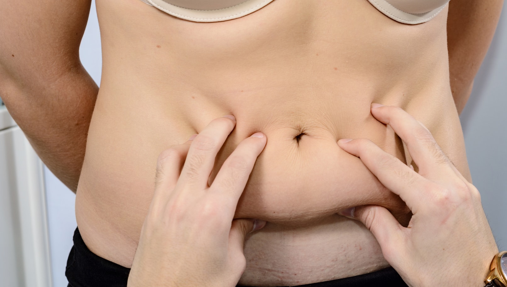 Tummy Tuck vs. Panniculectomy