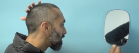 Doctor Becomes the Patient - Meet the Hair Restoration Surgeon having a Hair Transplant