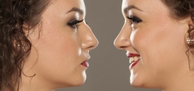 Crooked Nose - Cosmetic Surgery Solutions