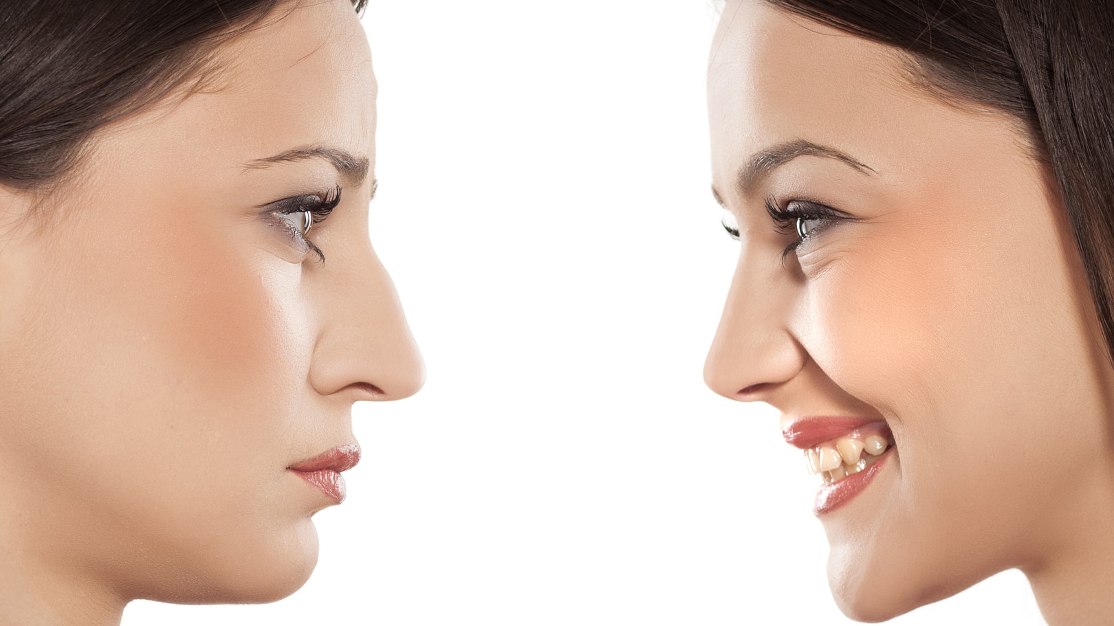 Adolescent Rhinoplasty