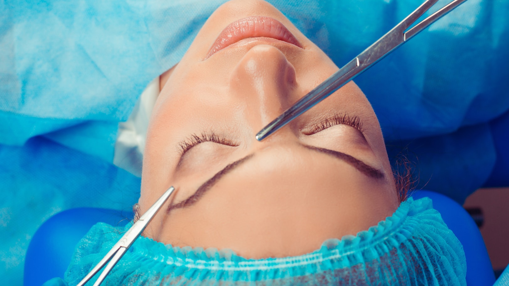 Coronal Brow Lift