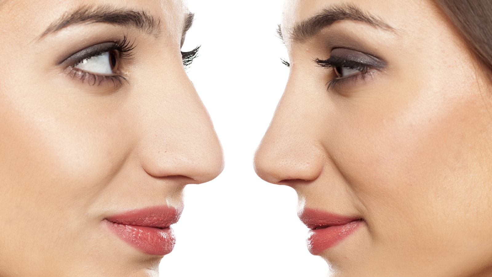 Ethnic Rhinoplasty