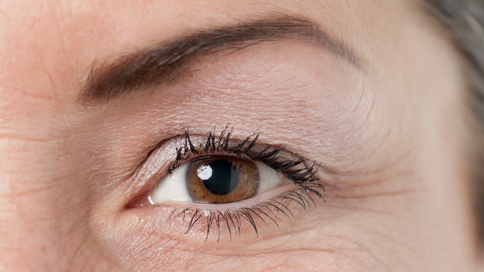 Eyelid Retraction Repair