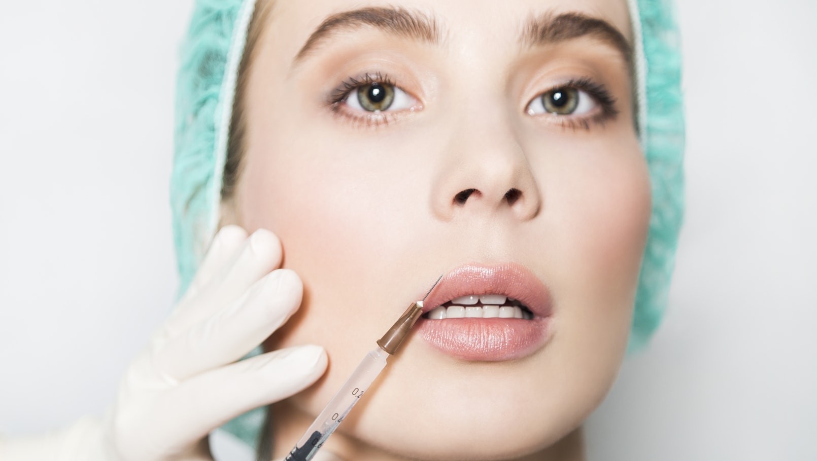 Fat Grafting in Lip Augmentation