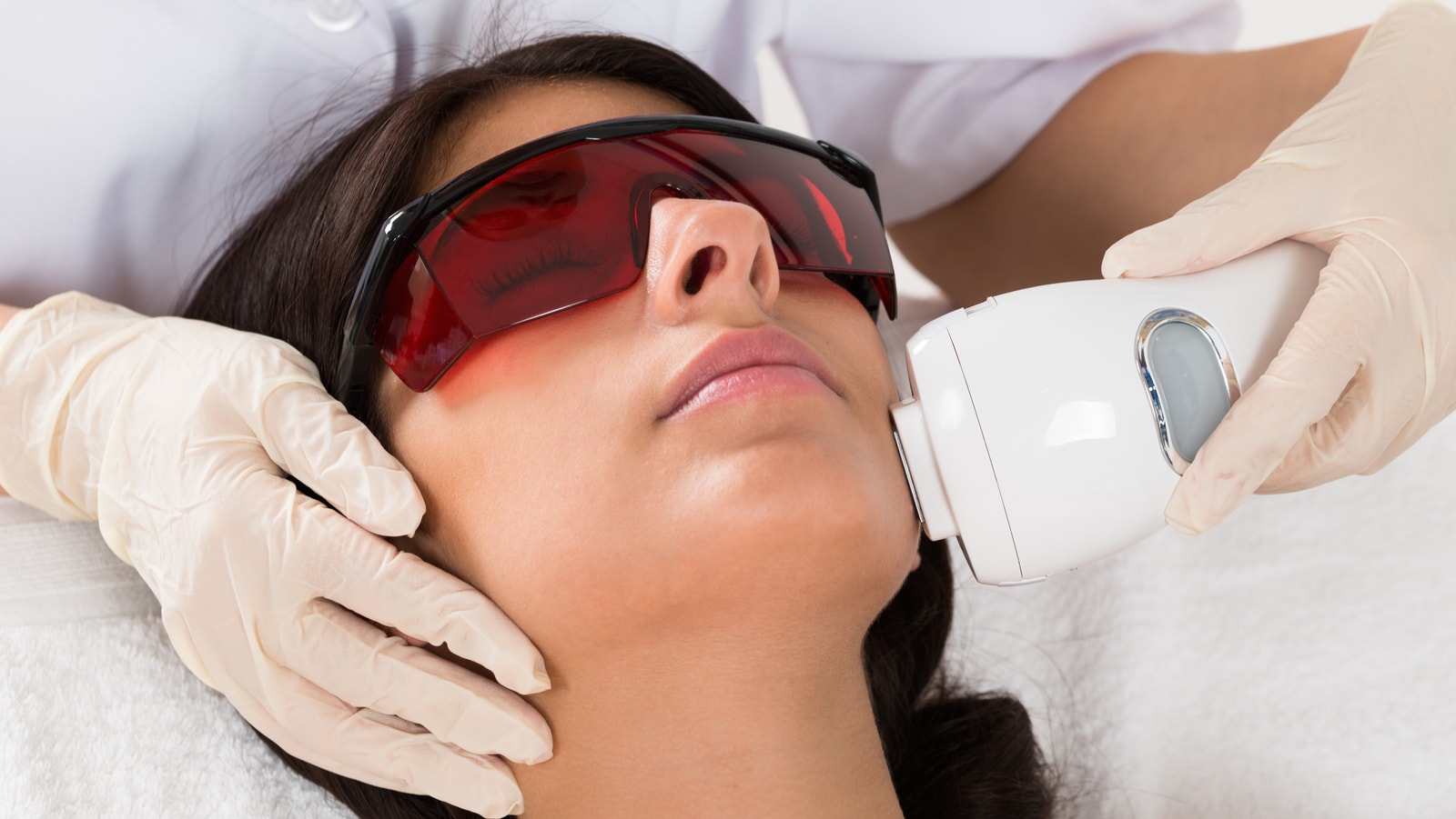 Laser Acne Treatment