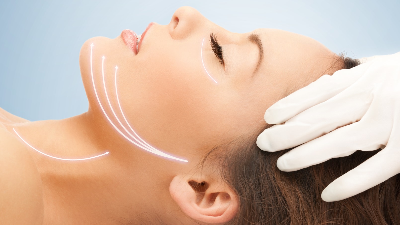 Laser Assisted Facelift and Neck Lift