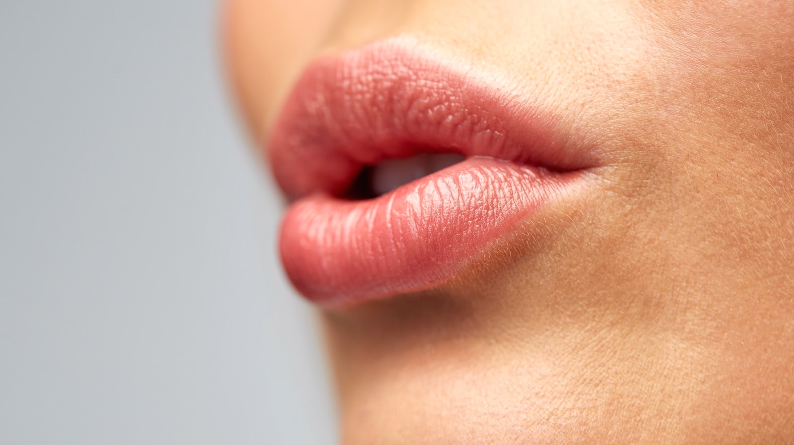 Lip Augmentation
