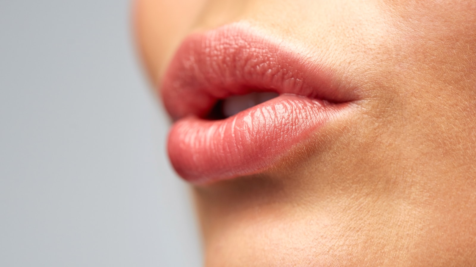 Lip Augmentation