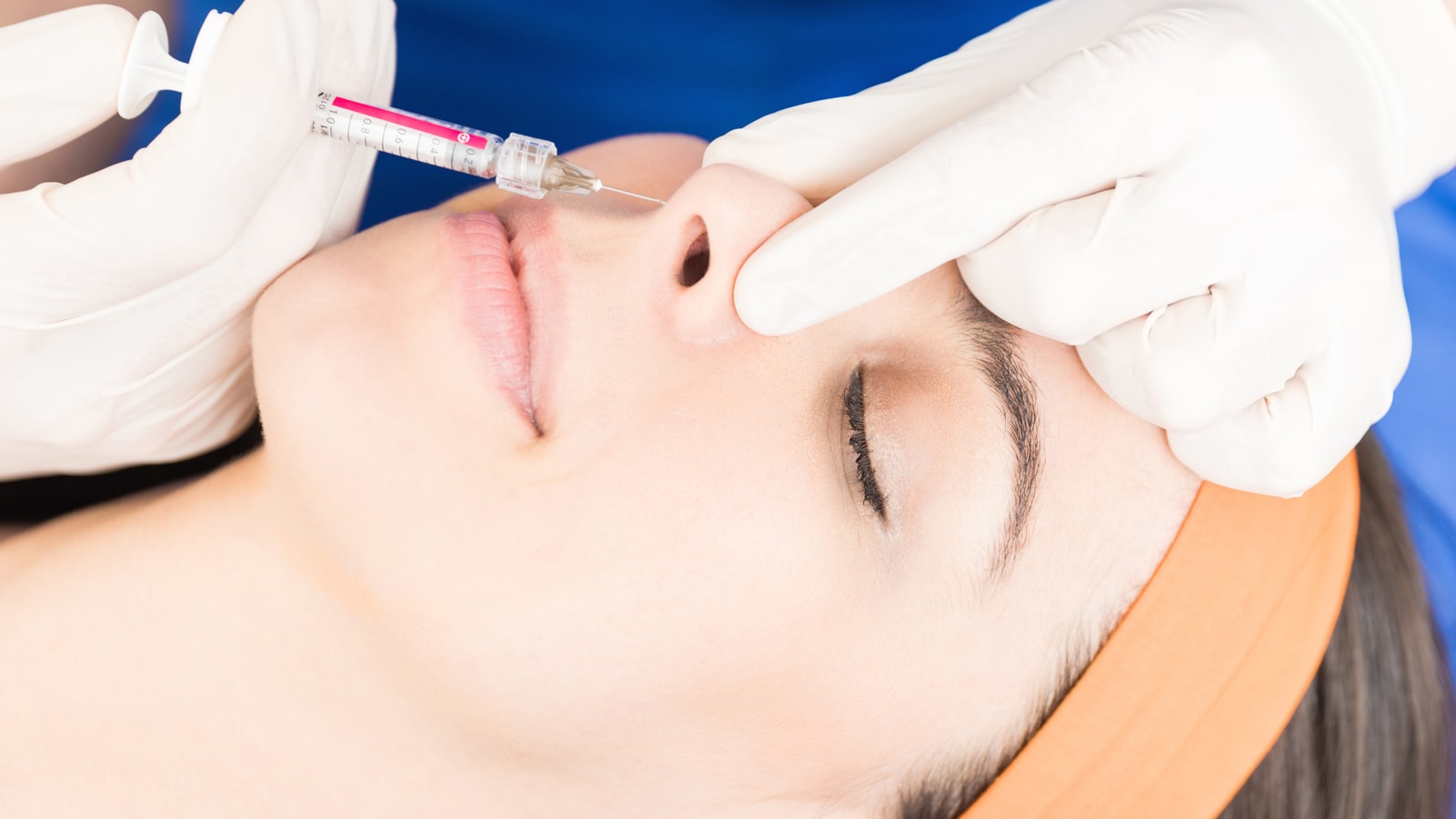 Non Surgical Rhinoplasty