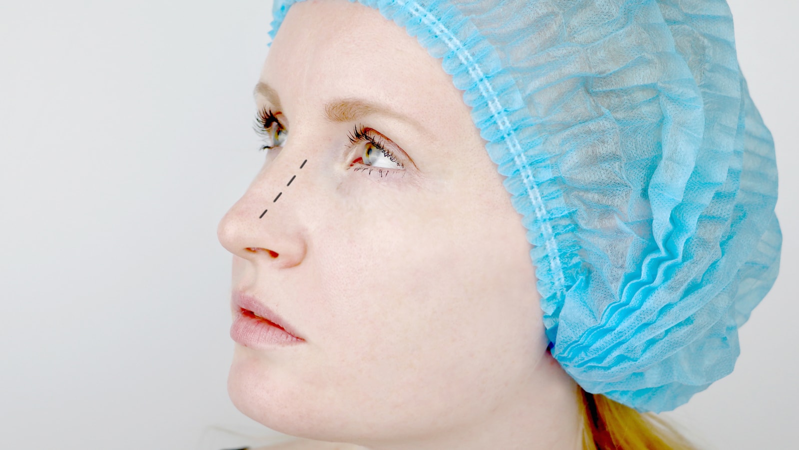 Reconstructive Rhinoplasty