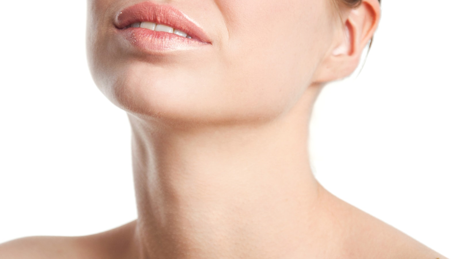 Submental Neck Lift