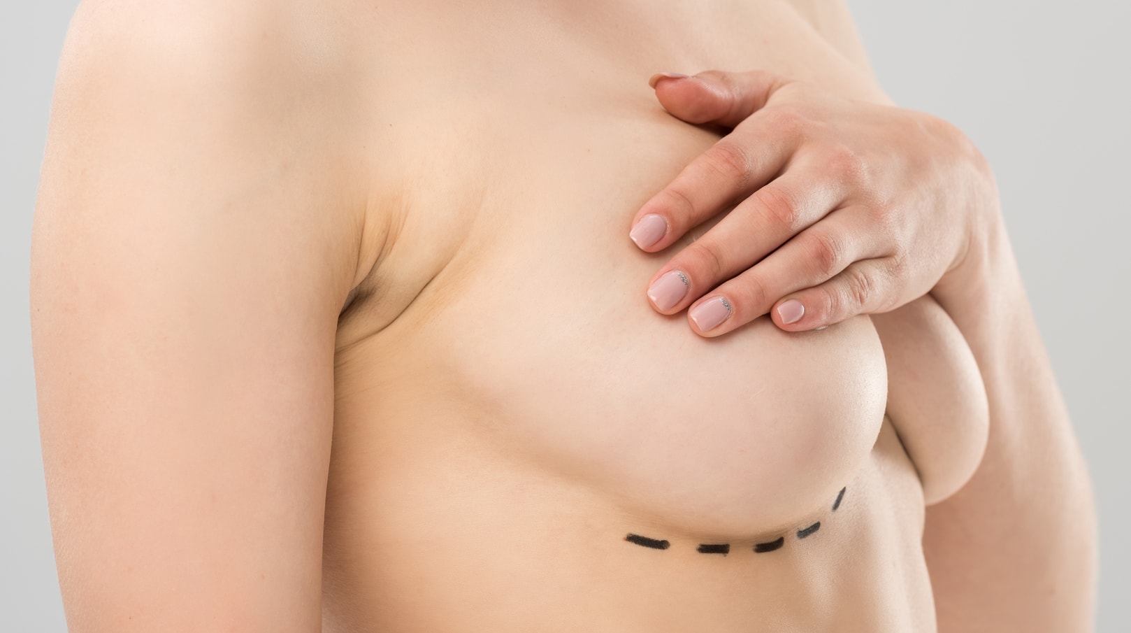 Types of Breast Lifts