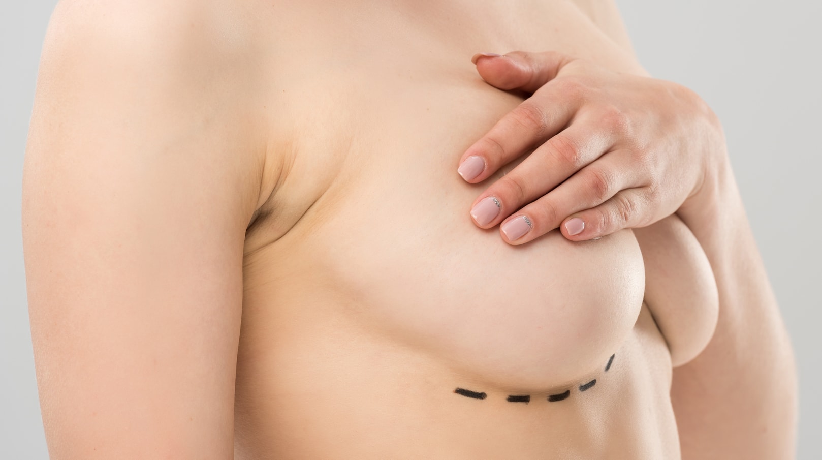 Learn About the Different Types of Breast Lifts