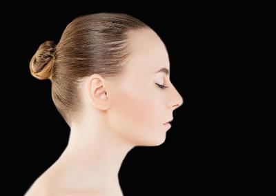 Rhinoplasty