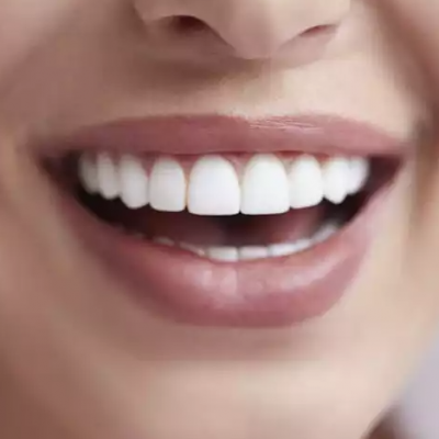 Teeth, Teeth, Teeth Teeth, Teeth, Teeth Teeth, Teeth, Teeth Teeth, Teeth, T