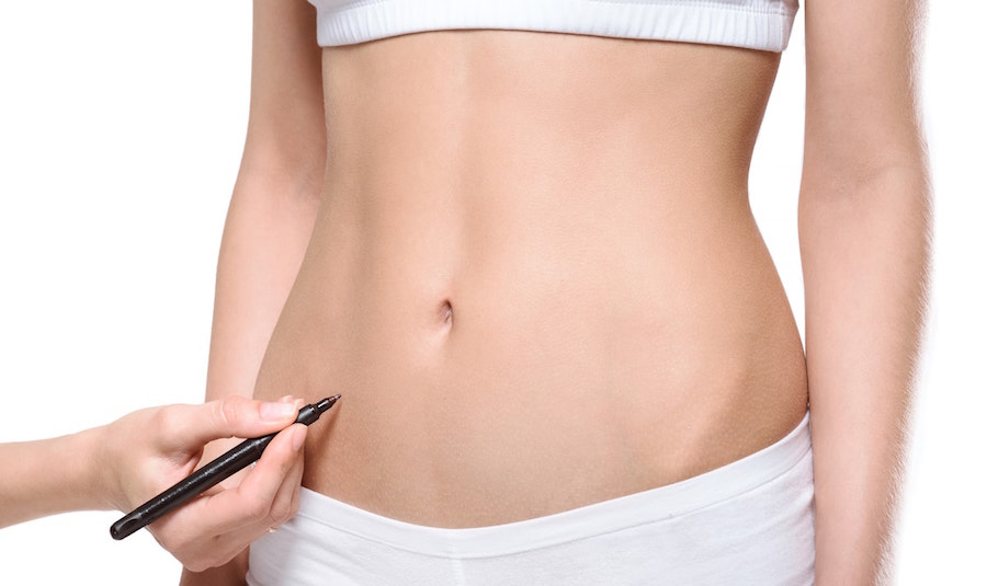 All the details on liposuction