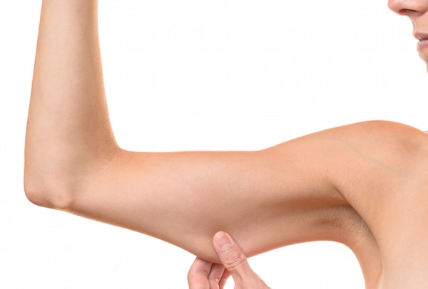 Patients Are Now Using Radiesse To Combat Flabby Arms 