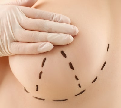 Benefits of Breast Implant Removal