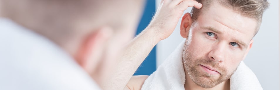 Hair loss hope as biotech startups target balding