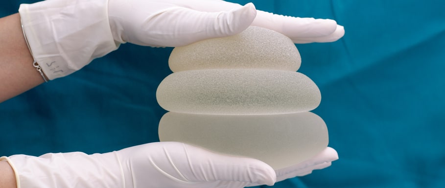 Lifespan of breast implants