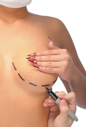 Breast Reduction Reasons Not to Have Procedure