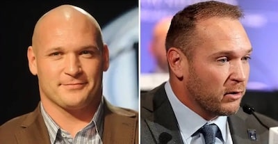 Brian Urlacher Hair Transplant