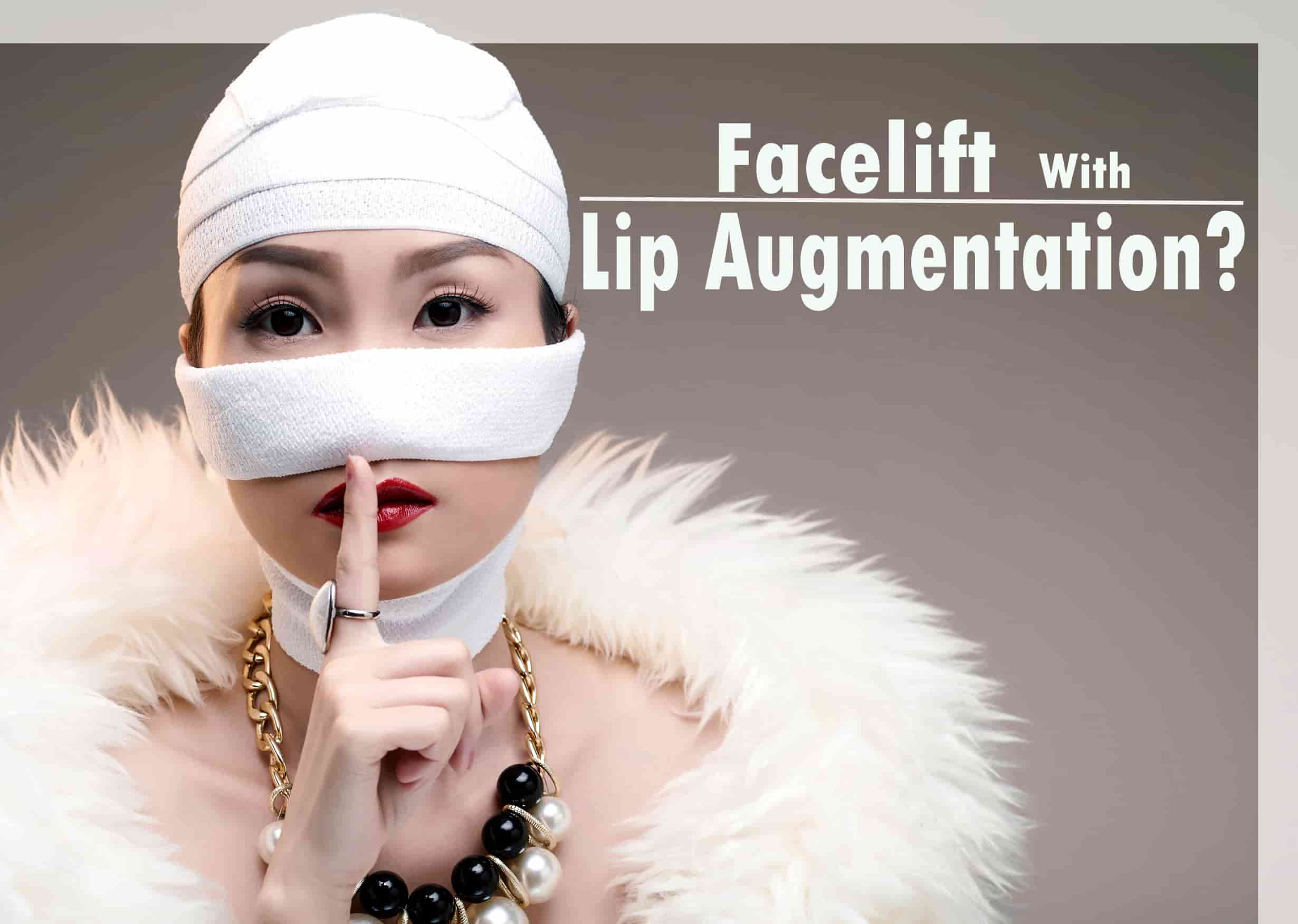 Facelift: A Promising Lip Augmentation Technique?