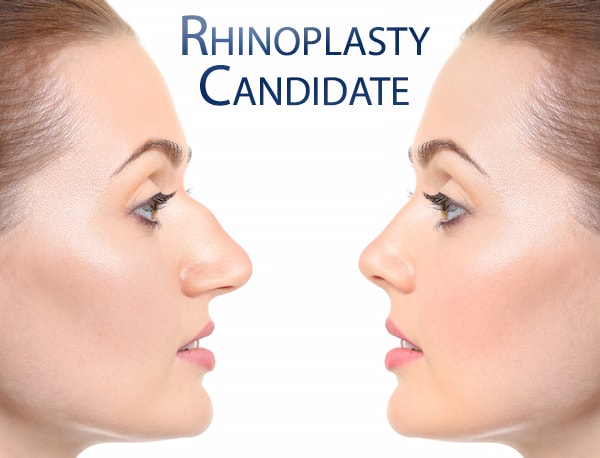 Who is an ideal candidate for having a rhinoplasty procedure